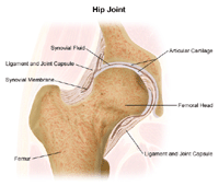 Hip Replacement Surgery