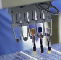 Photo of vials of blood at Network reference Lab at Christian Hospital